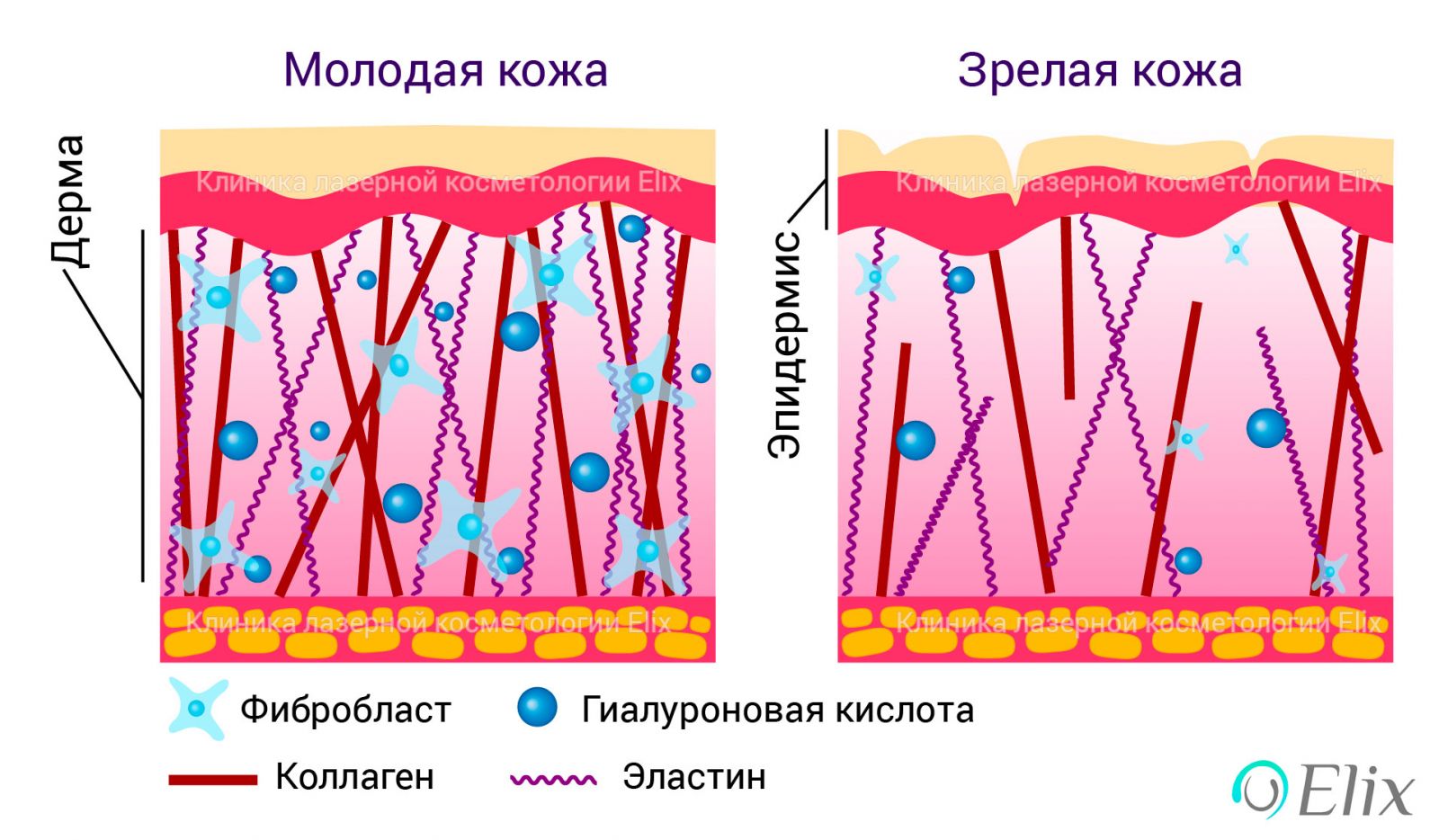 Коллагеновые волокна картинка